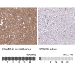 FAM241B Antibody, Novus Biologicals 25 &mu;L; Unlabeled:Antibodies, Polyclonal